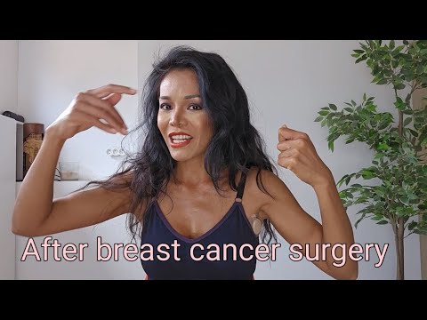 After breast cancer surgery