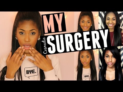 I GOT COSMETIC SURGERY!