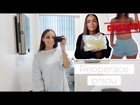 Moje reaugmentace, průběh hojení a jak teď prsa vypadají? | Týnuš Třešničková