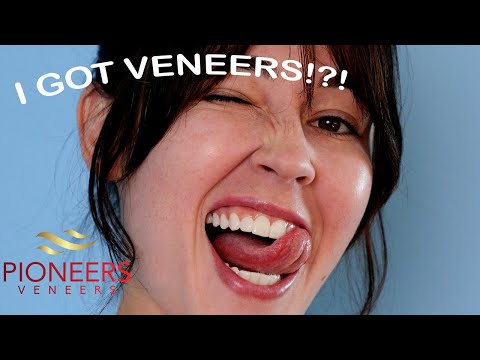 Trying Snap-On Veneers from Pioneers Veneers!!