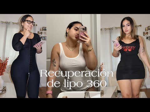 Cuidados después de una Lipo 360