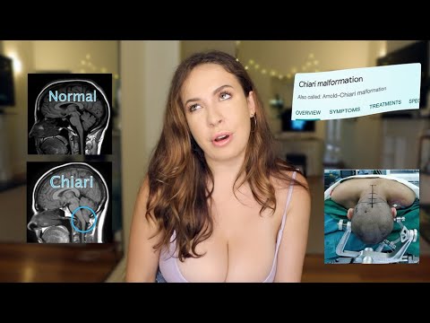 I’m getting BRAIN SURGERY (Story time)